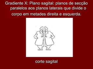Gradiente X: Plano sagital: planos de secçãoGradiente X: Plano sagital: planos de secção
paralelos aos planos laterais que divide oparalelos aos planos laterais que divide o
corpo em metades direita e esquerda.corpo em metades direita e esquerda.
corte sagitalcorte sagital
 