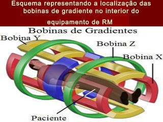 Esquema representando a localização das
bobinas de gradiente no interior do
equipamento de RM
 
