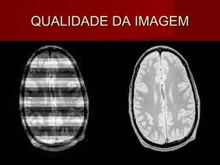 QUALIDADE DA IMAGEMQUALIDADE DA IMAGEM
 