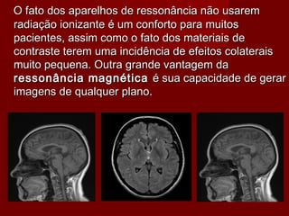 O fato dos aparelhos de ressonância não usaremO fato dos aparelhos de ressonância não usarem
radiação ionizante é um conforto para muitosradiação ionizante é um conforto para muitos
pacientes, assim como o fato dos materiais depacientes, assim como o fato dos materiais de
contraste terem uma incidência de efeitos colateraiscontraste terem uma incidência de efeitos colaterais
muito pequena. Outra grande vantagem damuito pequena. Outra grande vantagem da
ressonância magnéticaressonância magnética é sua capacidade de geraré sua capacidade de gerar
imagens de qualquer plano.imagens de qualquer plano.
 