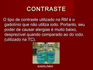 CONTRASTECONTRASTE
O tipo de contraste utilizado na RM é oO tipo de contraste utilizado na RM é o
gadolínio que não utiliza iodo. Portanto, seugadolínio que não utiliza iodo. Portanto, seu
poder de causar alergias é muito baixo,poder de causar alergias é muito baixo,
desprezível quando comparado ao do iodo.desprezível quando comparado ao do iodo.
(utilizado na TC).(utilizado na TC).
GADOLÍNEO
 
