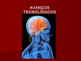 AVANÇOS
TECNOLÓGICOS
 