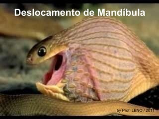 Deslocamento de Mandíbula by Prof. LENO / 2011 