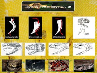 Tipos de Presas inoculadoras
 