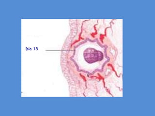 Dia 13
 