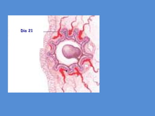 Dia 21
 