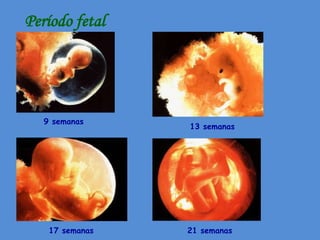 Período fetal




   9 semanas
                 13 semanas




    17 semanas   21 semanas
 