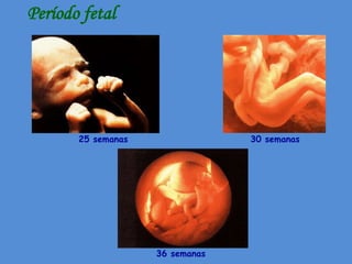 Período fetal




       25 semanas                30 semanas




                    36 semanas
 