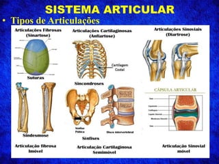 SISTEMA ARTICULAR
• Tipos de Articulações
 