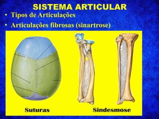 SISTEMA ARTICULAR
• Tipos de Articulações
• Articulações fibrosas (sinartrose)
 
