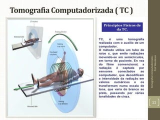 Tomografia Computadorizada ( TC )
TomografiaComputadorizada-
ProfWendesor
11
 
