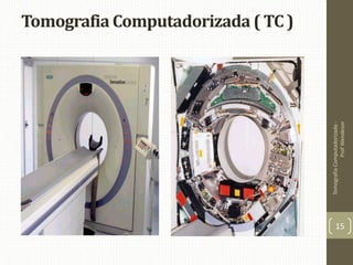 Tomografia Computadorizada ( TC )
TomografiaComputadorizada-
ProfWendesor
15
 