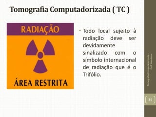 Tomografia Computadorizada ( TC )
• Todo local sujeito à
radiação deve ser
devidamente
sinalizado com o
símbolo internacional
de radiação que é o
Trifólio.
TomografiaComputadorizada-
ProfWendesor
35
 