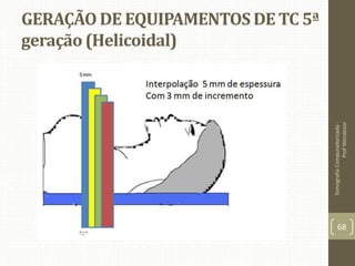 GERAÇÃO DE EQUIPAMENTOS DE TC 5ª
geração (Helicoidal)
TomografiaComputadorizada-
ProfWendesor
68
 
