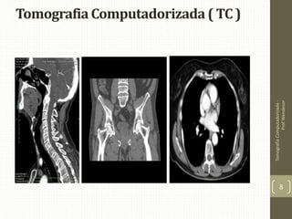 Tomografia Computadorizada ( TC )
TomografiaComputadorizada-
ProfWendesor
8
 