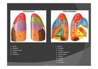 1 – Apical 1 – Apical
2 – Posterior 2 – Posterior
6 – Superior apical 3 – Anterior
9 – Lateral 5 – Medial lingular inf.
10 – Posterior 6 – Super apical
7 – Medial
8 – Anterior
9 – Lateral
10 - Posterior
www.playmagem.com.br
 
