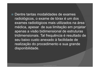 Dentre tantas modalidades de exames
radiológicos, o exame de tórax é um dos
exames radiológicos mais utilizados na área
médica, apesar de sua limitação em projetar
apenas a visão bidimensional de estruturas
tridimensionais. Tal frequência é resultado detridimensionais. Tal frequência é resultado de
seu baixo custo anexado à facilidade de
realização do procedimento e sua grande
disponibilidade.
www.playmagem.com.br
 