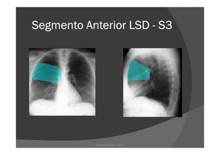 Segmento Anterior LSDSegmento Anterior LSDSegmento Anterior LSDSegmento Anterior LSD ---- S3S3S3S3
www.playmagem.com.br
 