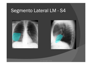 Segmento Lateral LMSegmento Lateral LMSegmento Lateral LMSegmento Lateral LM ---- S4S4S4S4
www.playmagem.com.br
 