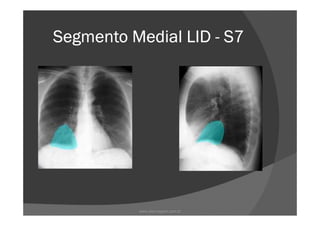 Segmento Medial LIDSegmento Medial LIDSegmento Medial LIDSegmento Medial LID ---- S7S7S7S7
www.playmagem.com.br
 