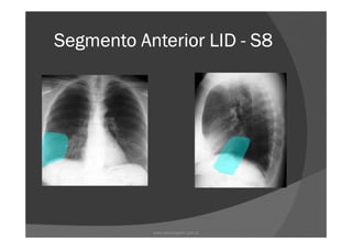 Segmento Anterior LIDSegmento Anterior LIDSegmento Anterior LIDSegmento Anterior LID ---- S8S8S8S8
www.playmagem.com.br
 