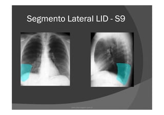 Segmento Lateral LIDSegmento Lateral LIDSegmento Lateral LIDSegmento Lateral LID ---- S9S9S9S9
www.playmagem.com.br
 