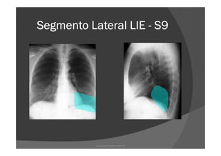 Segmento Lateral LIESegmento Lateral LIESegmento Lateral LIESegmento Lateral LIE ---- S9S9S9S9
www.playmagem.com.br
 