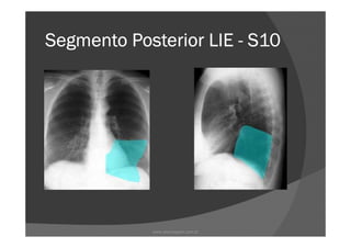Segmento Posterior LIESegmento Posterior LIESegmento Posterior LIESegmento Posterior LIE ---- S10S10S10S10
www.playmagem.com.br
 