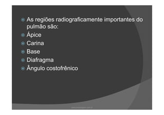 As regiões radiograficamente importantes do
pulmão são:
Ápice
Carina
Base
DiafragmaDiafragma
Ângulo costofrênico
www.playmagem.com.br
 