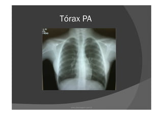 Tórax PA
www.playmagem.com.br
 