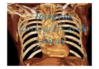 ImagensImagens
tomográficastomográficastomográficastomográficastomográficastomográficastomográficastomográficas dodotomográficastomográficastomográficastomográficastomográficastomográficastomográficastomográficas
tóraxtórax
www.playmagem.com.br
 