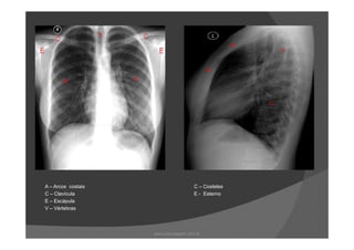 A – Arcos costais C – Costelas
C – Clavícula E - Esterno
E – Escápula
V – Vértebras
www.playmagem.com.br
 