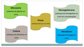Glicosúria
presença de glicose na
urina
Hematúria
presença de sangue na
urina
Hemoglobinúria
presença de hemoglobina na
urina em concentrações
Colúria
presença de bilirrubina na
urina
Piúria
presença de pus na urina
 