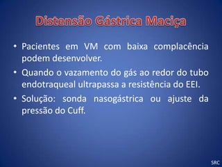 • Pacientes em VM com baixa complacência
  podem desenvolver.
• Quando o vazamento do gás ao redor do tubo
  endotraqueal ultrapassa a resistência do EEI.
• Solução: sonda nasogástrica ou ajuste da
  pressão do Cuff.




                                                  SRC
 