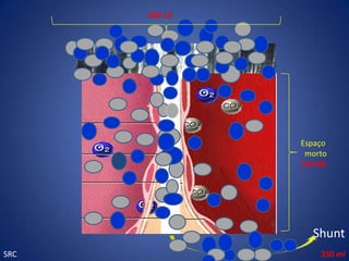 500 ml




               Espaço
                morto
               150 ML




                 Shunt
SRC                350 ml
 