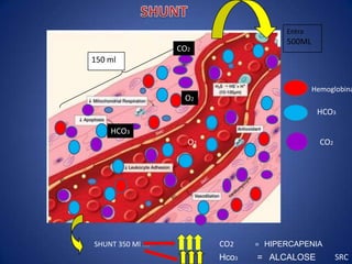 Entra
                                      500ML
                  CO2
150 ml


                                              Hemoglobina
                   O2
                                               HCO3

    HCO3
                    O2                          CO2




SHUNT 350 Ml ml          CO2    = HIPERCAPENIA
                         Hco3   = ALCALOSE            SRC
 