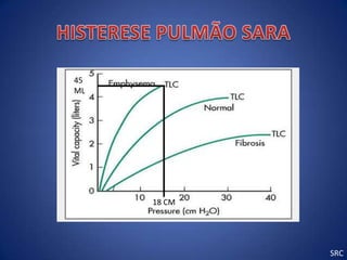 45
ML




     18 CM




             SRC
 
