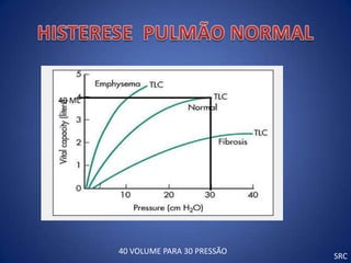 40 ML




        40 VOLUME PARA 30 PRESSÃO
                                    SRC
 