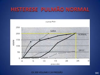 EX 200 VOLUME E 24 PRESSÃO   SRC
 