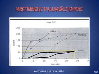 60 VOLUME E 24 DE PRESSÃO   SRC
 
