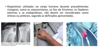 • Dispositivos utilizados no corpo humano durante procedimentos
cirúrgicos, como as osteossínteses, os fios de Kirschner, os fixadores
externos e as endopróteses, não devem ser considerados como
órteses ou próteses, segundo as definições apresentadas.
 