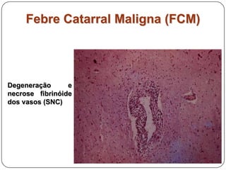 Febre Catarral Maligna (FCM)Degeneração e necrose fibrinóide dos vasos (SNC)