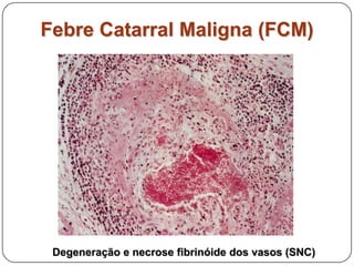 Febre Catarral Maligna (FCM)Degeneração e necrose fibrinóide dos vasos (SNC)