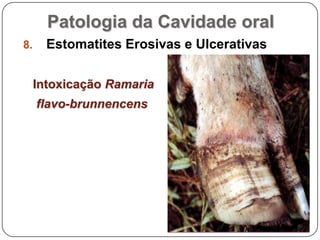 Patologia da Cavidade oralEstomatites Erosivas e UlcerativasIntoxicação Ramaria flavo-brunnencens