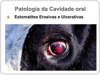 Patologia da Cavidade oralEstomatites Erosivas e Ulcerativas
