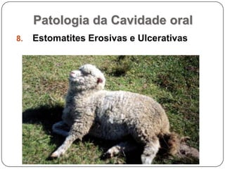 Patologia da Cavidade oralEstomatites Erosivas e Ulcerativas