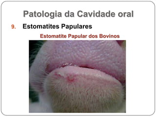 Patologia da Cavidade oralEstomatites PapularesEstomatite Papular dos Bovinos