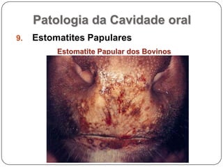Patologia da Cavidade oralEstomatites PapularesEstomatite Papular dos Bovinos