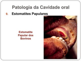 Patologia da Cavidade oralEstomatites PapularesEstomatite Papular dos Bovinos
