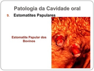 Patologia da Cavidade oralEstomatites PapularesEstomatite Papular dos Bovinos